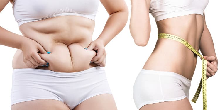 كم ينقص الوزن بعد عملية شفط الدهون؟ 1