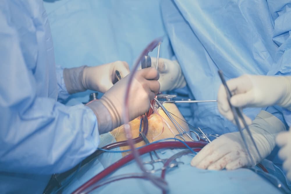 عملية القلب المفتوح من غرفة العمليات